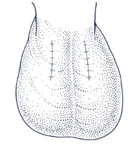 Scrotum-pic-3-274×300-1.jpg Scrotum-pic-3-274x300-1.jpg